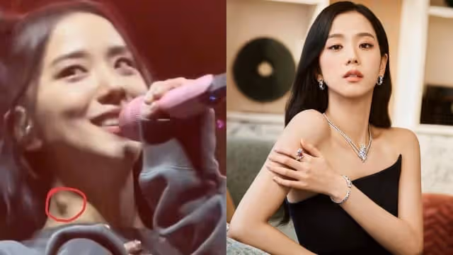 Jisoo頸部「腫起一塊」　引粉絲擔憂