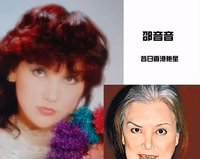 毀容女星邵音音年輕時有多美，杏眼瓜子臉美艷不可方物，可惜了！