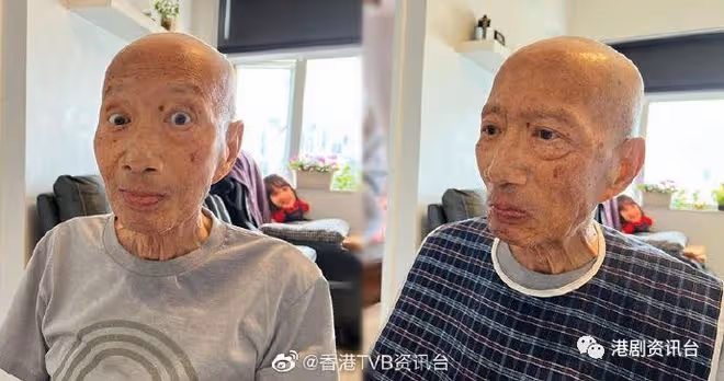 78歲TVB老戲骨痰多吞嚥困難入院！兒子表示︰近來身體明顯退步