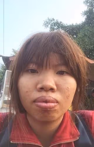 完全換臉！醜女沒人敢娶「狠花10萬整形變臉」 術後「變超美」人生大逆襲，爽嫁富二代