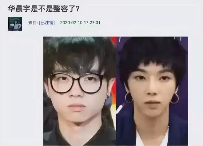 蔡徐坤被公司索賠79萬整容費!明明整容了卻打死不承認,打臉了吧