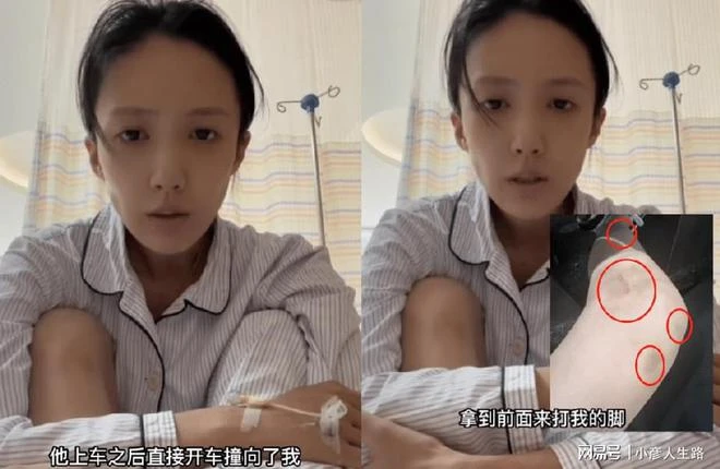 王東妻子住院哭，稱公公開車撞她，臉色憔悴面頰塌陷腿多處淤青