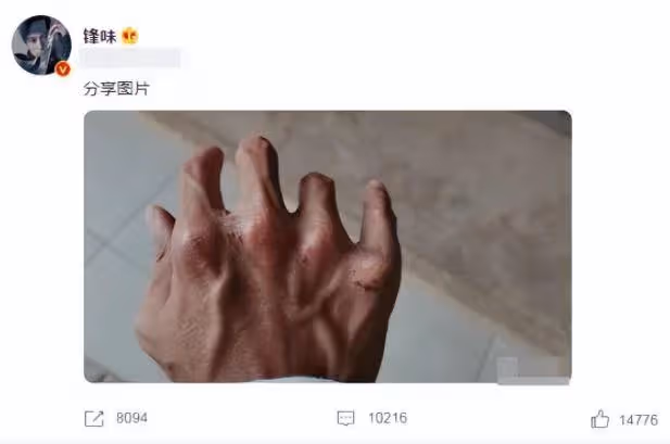 42歲謝霆鋒近照引擔憂！身形消瘦手指全是傷，細節透露與王菲沒分