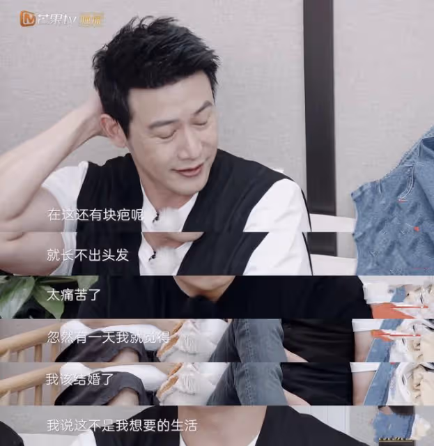 陸毅自曝曾患抑鬱症，用菸灰缸砸腦袋自殘，傷口處已長不出頭髮
