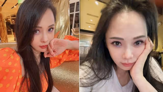 認動用醫美　伊能靜：這很正常
