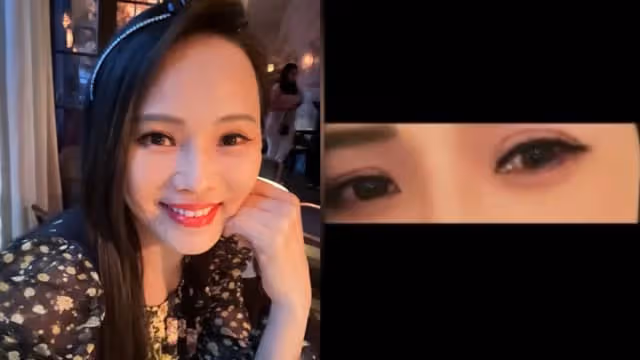 認動用醫美　伊能靜：這很正常