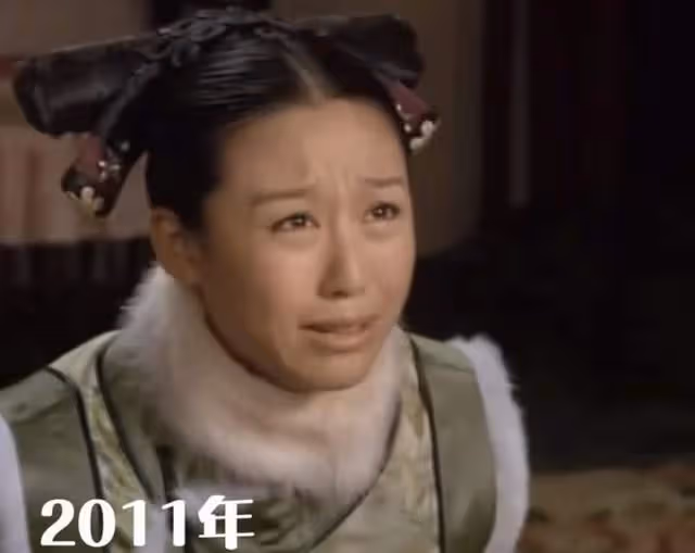 甄嬛傳「寶娟」被疑整容！錐子臉銅鈴眼似外星人，模樣怪異認不出