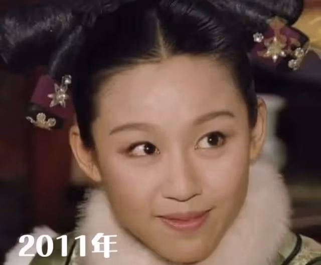 甄嬛傳「寶娟」被疑整容！錐子臉銅鈴眼似外星人，模樣怪異認不出