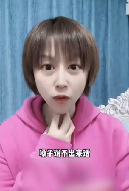 甄嬛傳「寶娟」被疑整容！錐子臉銅鈴眼似外星人，模樣怪異認不出