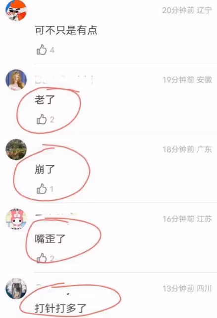 宋慧喬越來越像蔡明？臉僵了，狀態大不如前，衣品也一言難盡