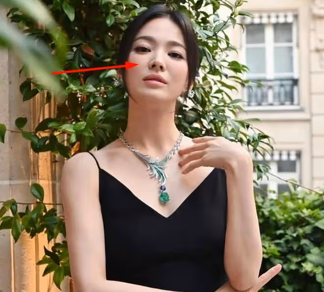 宋慧喬越來越像蔡明？臉僵了，狀態大不如前，衣品也一言難盡
