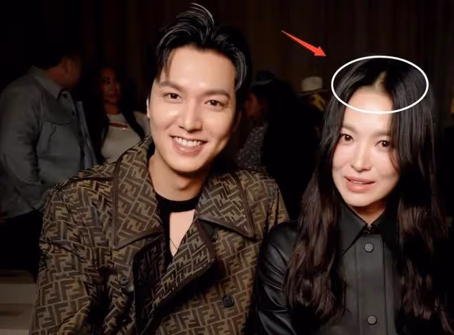 宋慧喬越來越像蔡明？臉僵了，狀態大不如前，衣品也一言難盡