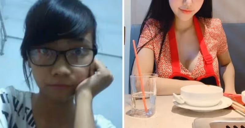 醜小鴨變天鵝！女生「偷偷整形」變成網美臉　回家後「鄰居全不認得」媽媽也傻眼氣翻：別跟我說話