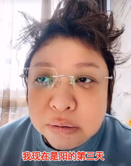 韓紅確診新冠第3天症狀嚴重，嘴唇乾裂發白，臉腫嘴歪咳嗽不止