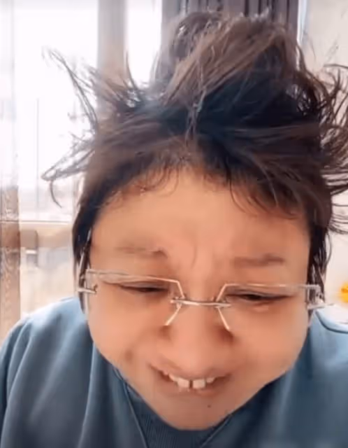 韓紅確診新冠第3天症狀嚴重，嘴唇乾裂發白，臉腫嘴歪咳嗽不止