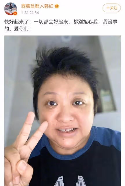 韓紅確診新冠第3天症狀嚴重，嘴唇乾裂發白，臉腫嘴歪咳嗽不止