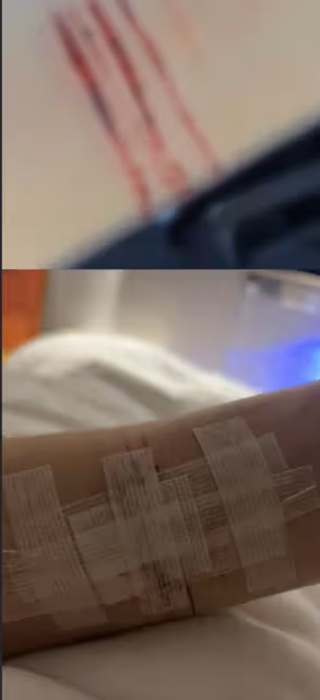 邵晴否認插足買超婚姻,曬傷口稱有抑鬱症曾割腕自殺,父母被網暴