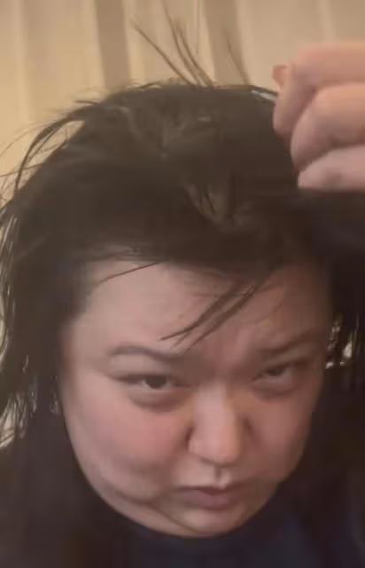 憔悴!TVB前搞笑女星曬生病近況,曝三天沒洗頭沒洗澡連狗都嫌臭