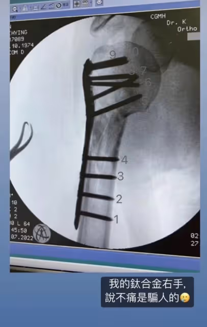 林志穎曬兒子們過聖誕，雙胞胎兒子認真拆禮物，13歲Kimi身材好壯