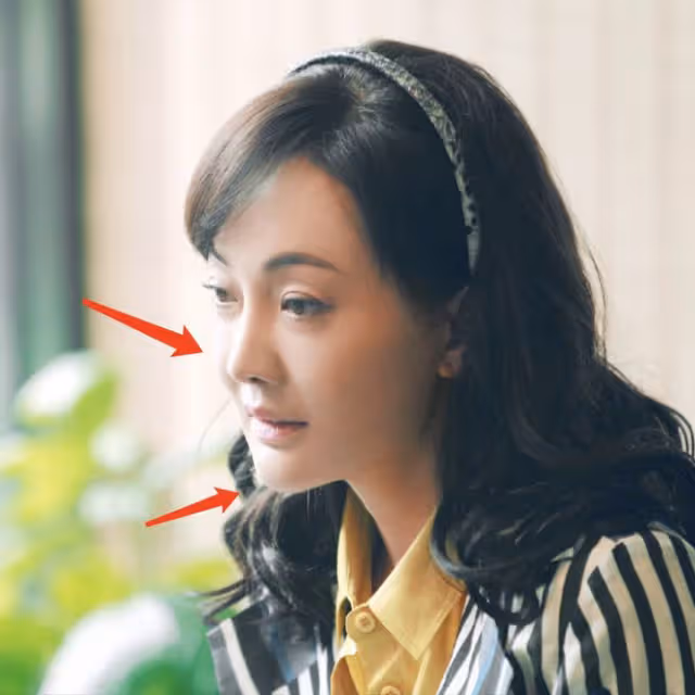 臉皮聳拉、額頭臃腫、表情僵硬，「整容」後的中年演員都翻車了
