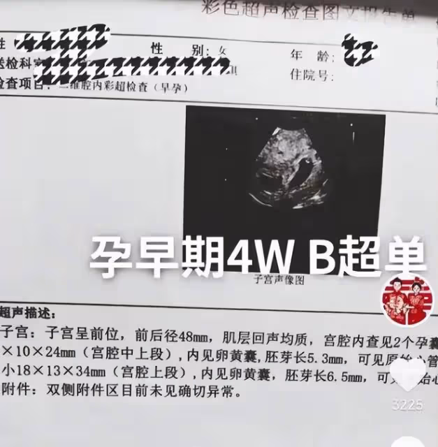 大衣哥著急了：陳萌暫時不考慮結婚，朱小偉婚事只能往後推