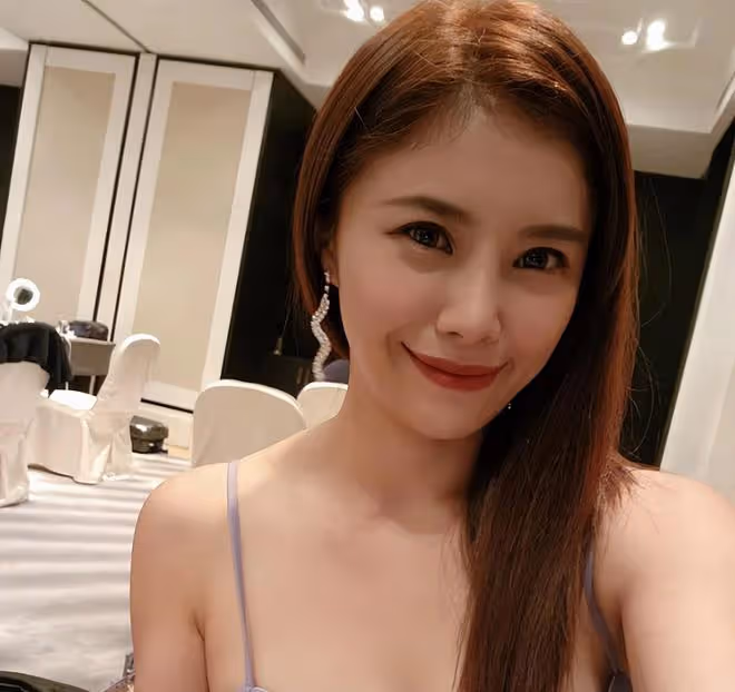 35歲美女主播車禍毀容!頭撞地昏迷腦出血,緊急送醫傷勢照曝光