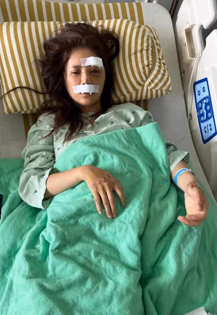 35歲美女主播車禍毀容!頭撞地昏迷腦出血,緊急送醫傷勢照曝光