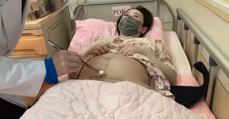 5天前喜迎愛女！34歲女星產後「肚子鬆垮像懷胎6月」　忍淚曝照片「驚見超深傷疤」網鼻酸：媽媽真的很偉大