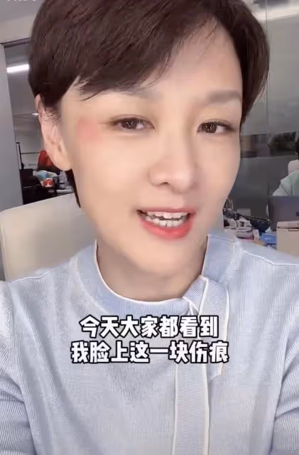 主持人李小萌被疑遭家暴,眼旁傷痕明顯,本人出面回應身體引擔憂