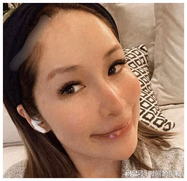 「清純玉女」到「滿臉科技」，這3位整容的女星，一個比一個心酸