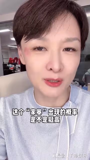 主持人李小萌疑被家暴，右眼紅腫，本人火速回應！