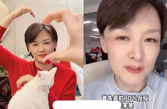 前央視女主持人李小萌否認家暴傳聞，稱陽康後撞牆，記憶直接斷片
