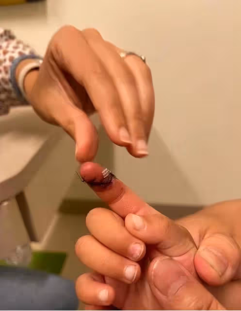 張恆曝鄭爽疑似美國虐童！兒女手指縫五針傷痕嚴重，稱害怕媽媽