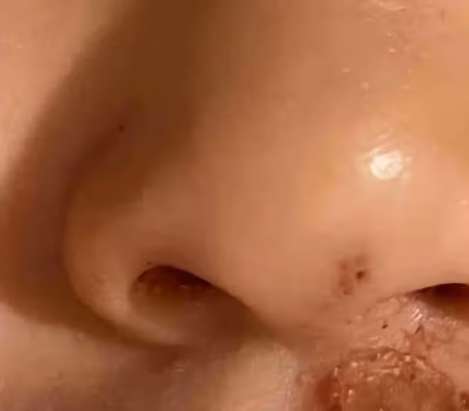張恆曝鄭爽疑似美國虐童！兒女手指縫五針傷痕嚴重，稱害怕媽媽