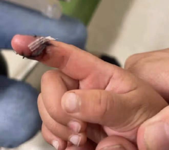 張恆指控鄭爽虐童，被曝因證據不足駁回指控，他計劃告兒童保護局