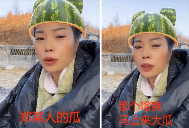 張恆控訴鄭爽虐童!孩子被縫5針,身上驚現煙疤,哭訴說害怕媽媽