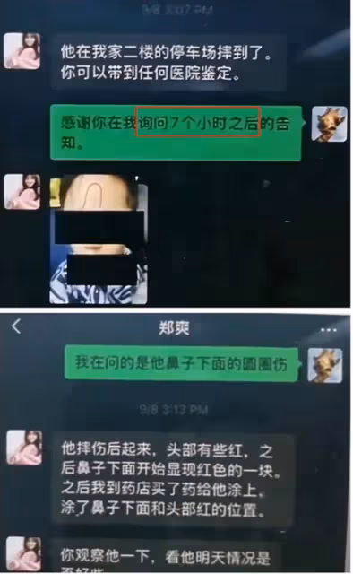 張恆控訴鄭爽虐童!孩子被縫5針,身上驚現煙疤,哭訴說害怕媽媽