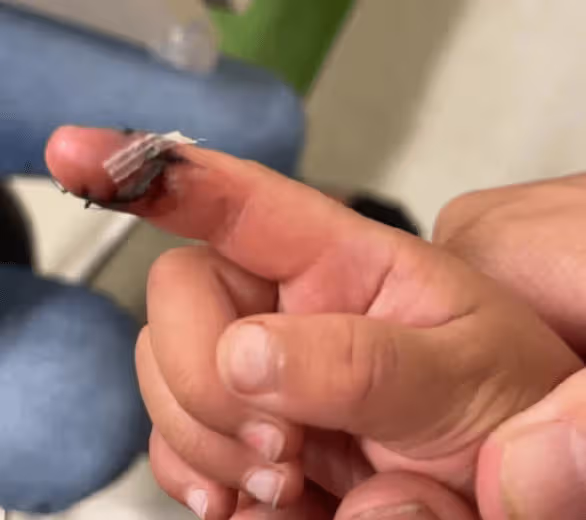 張恆爆鄭爽在美國虐待孩子！公開大量照片視頻，兒女受傷嚴重縫針