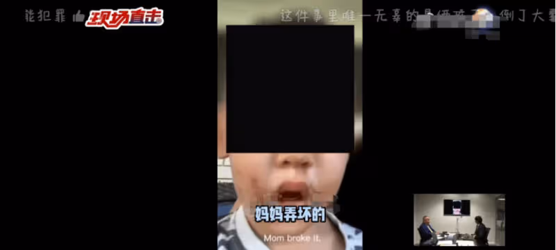 張恆爆鄭爽在美國虐待孩子！公開大量照片視頻，兒女受傷嚴重縫針
