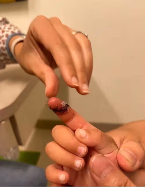 張恆爆鄭爽在美國虐待孩子！公開大量照片視頻，兒女受傷嚴重縫針
