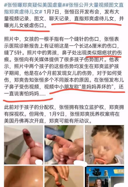 張恆控訴鄭爽虐待兒童後續，他已提起訴訟，孩子受傷照片細節曝光