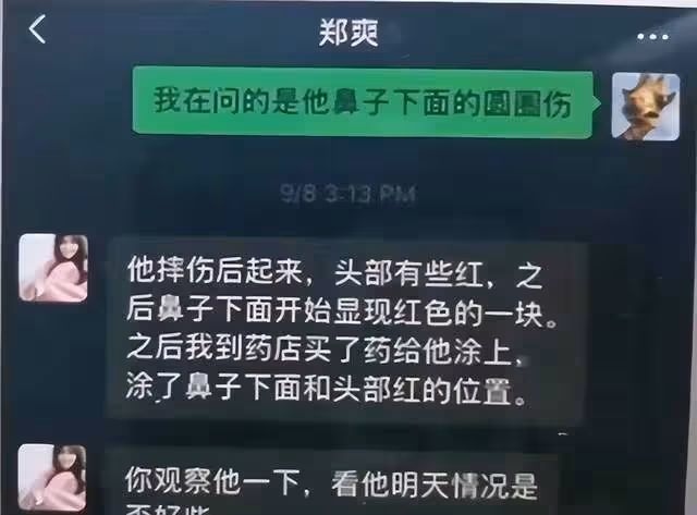 張恆控訴鄭爽虐待兒童後續，他已提起訴訟，孩子受傷照片細節曝光