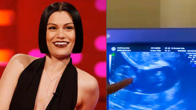 曾心痛流產　Jessie J時隔1年多驚喜宣布好消息！