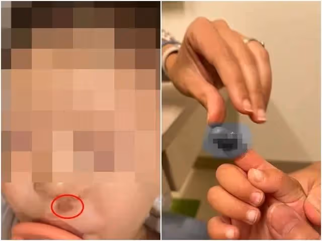 鄭爽遭前男友爆虐待兒童　女兒手指差點被割斷！