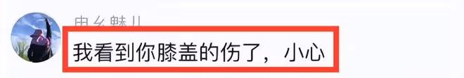 張馨予為何捷接長發，穿價值7萬元深V開叉裙秀身材，膝蓋傷痕明顯