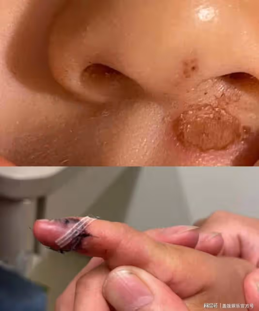 張恆發文怒懟鄭成華，讓其24小時內拿出證據，手握錄音截圖底氣足