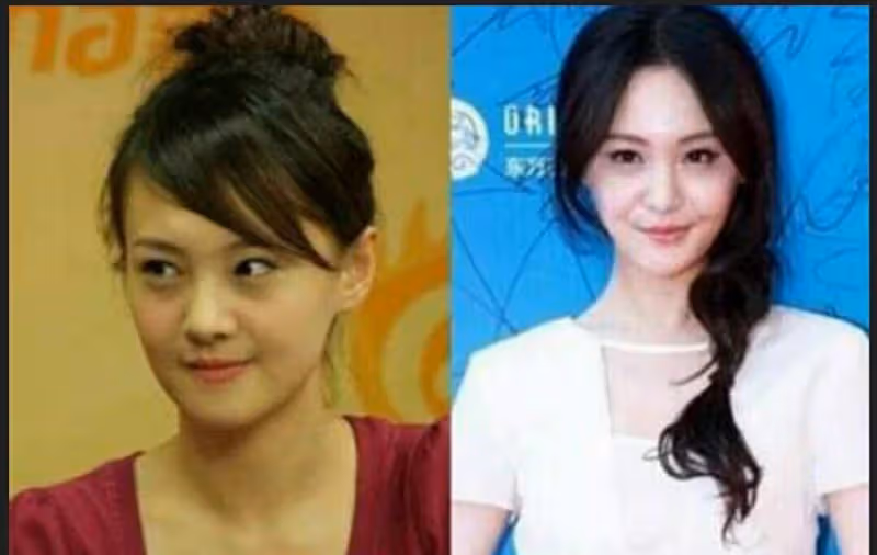 娛樂圈「大膽承認動過臉」的明星:周迅完全沒區別,看到伊能靜網直呼:判若兩人