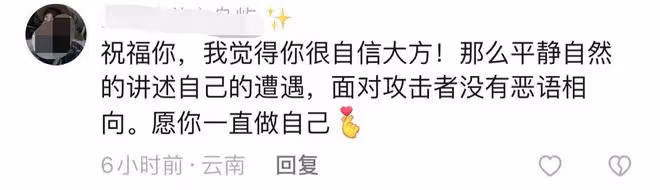 35歲演員承認五官整容！對比舊照變化大，首次自曝曾墜樓致嘴歪