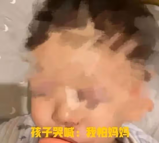 張恆怒了!公布鄭爽虐娃視頻孩子受傷嚴重,鄭爽不回國另有原因