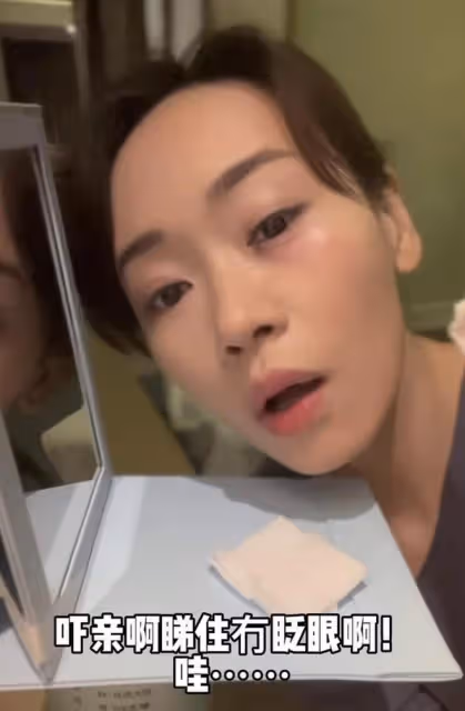 前TVB港姐冠軍楊思琦拍戲受傷，眼角現大片淤青，左眼險些致盲